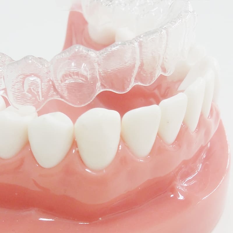 矯正歯科イメージ